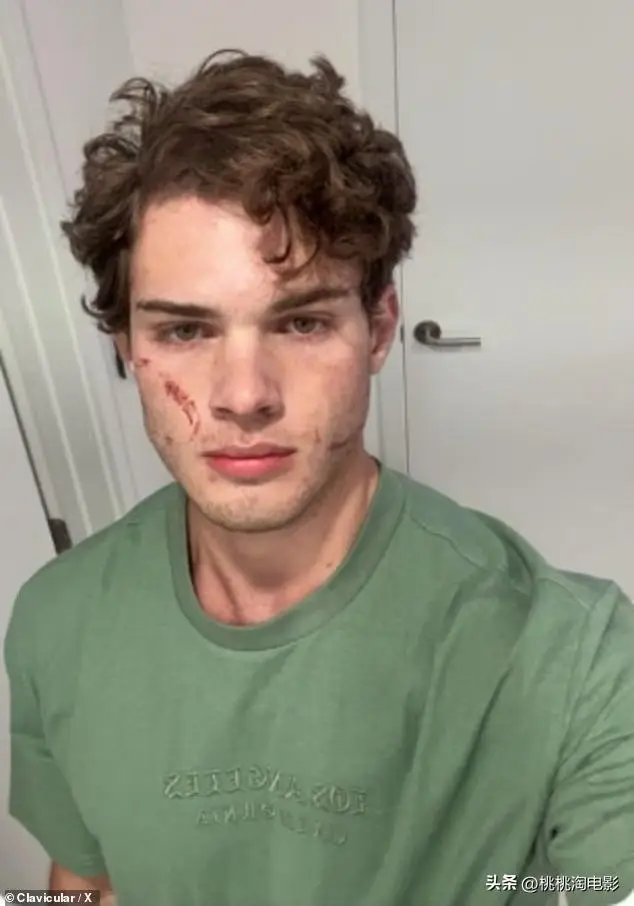 提倡碎骨美容的20歲網紅出事了！直播疑藥物過量，剛出院又赴夜店