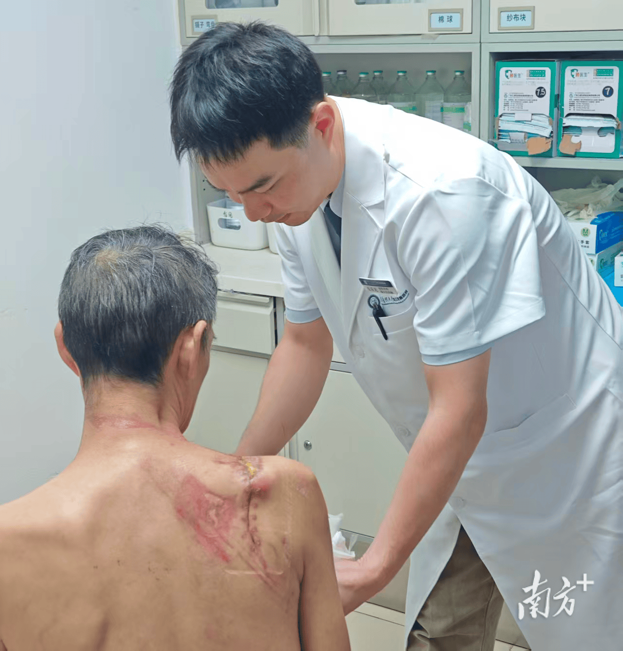 水泥攪拌機齒輪插入男子肩部，廣州醫院多學科搶救重建碎骨